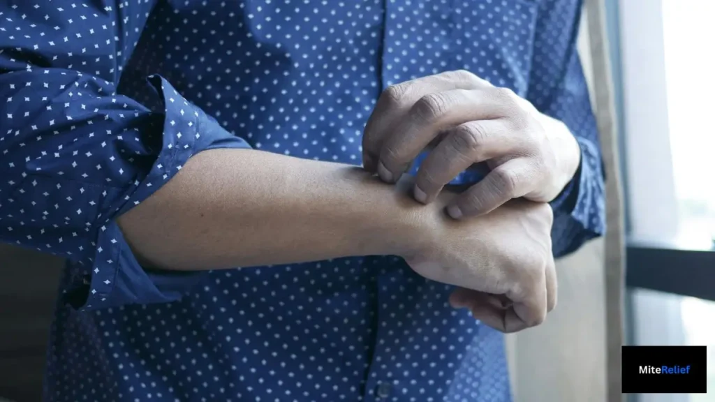 do dust mites bite skin causing itching and scratching